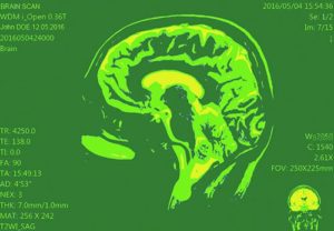 Green scan of brain